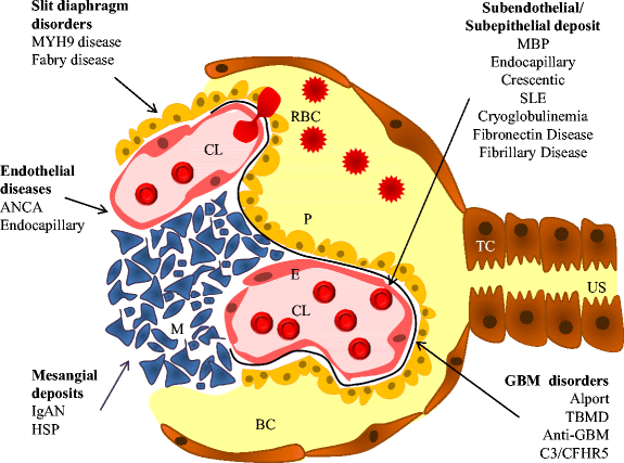 blood disease that starts with mylio blood disease that starts with mylio