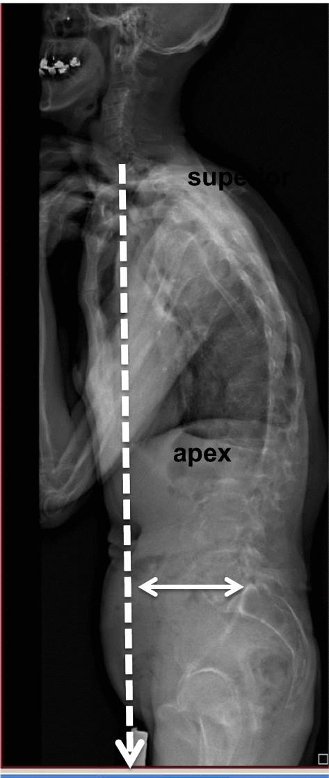 Fig. 13