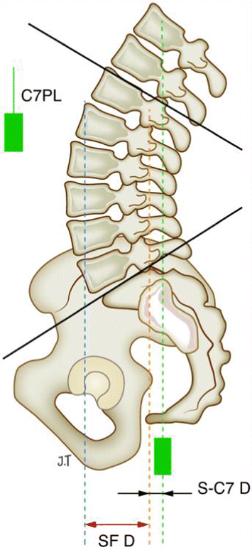 Fig. 16