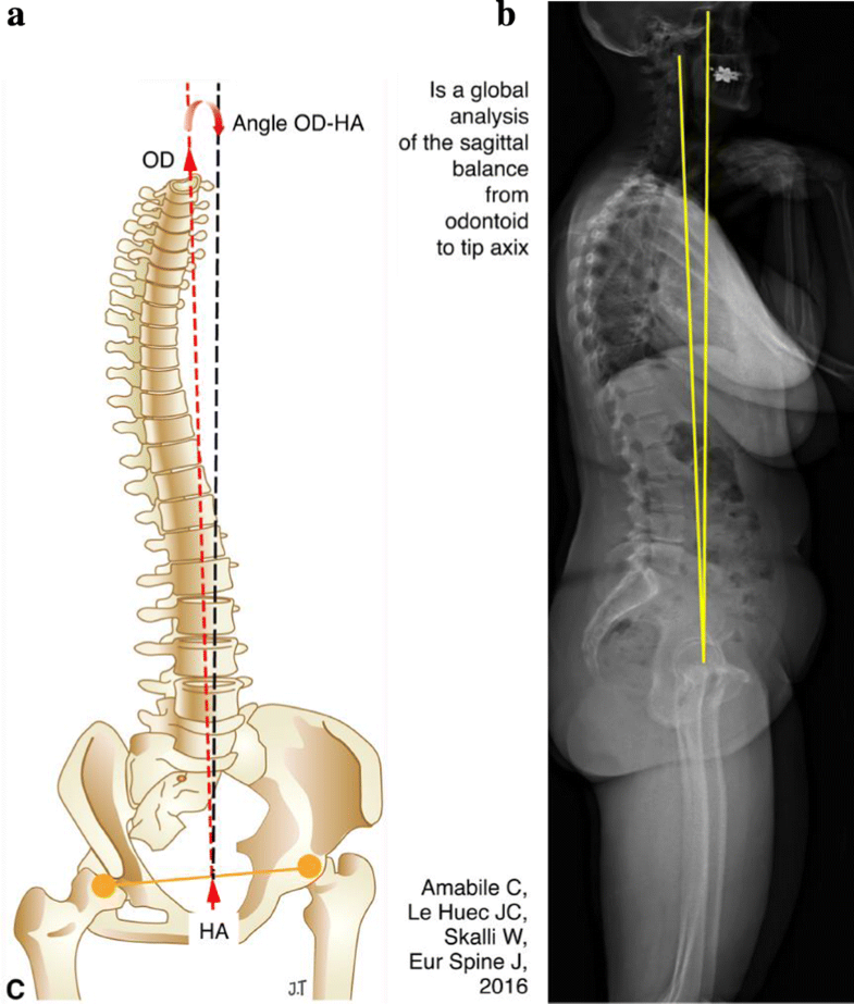 Fig. 19