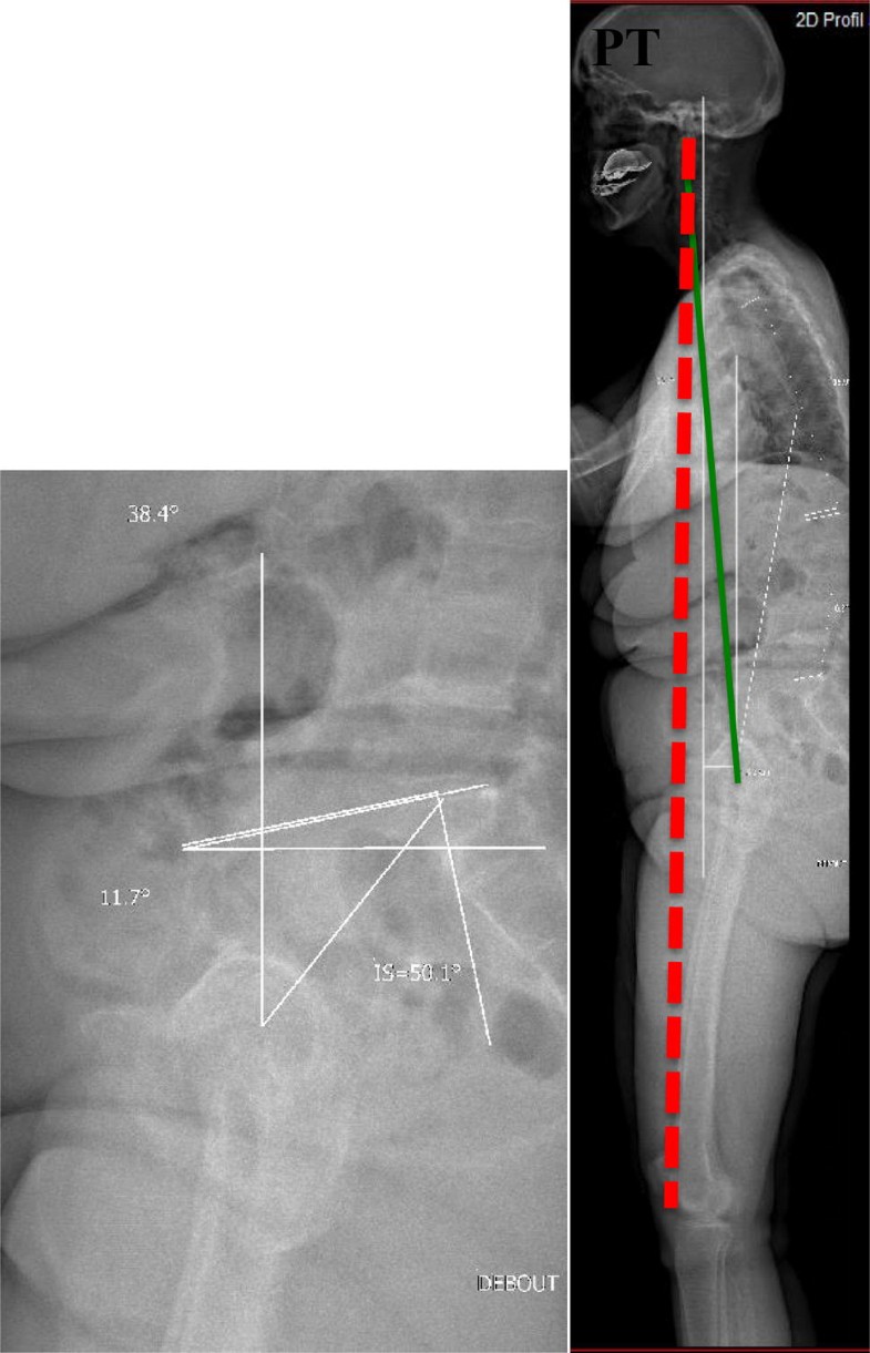 Fig. 21