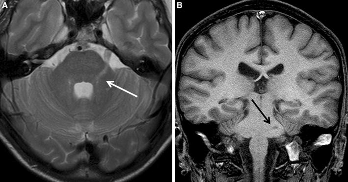 Neuroimage studies