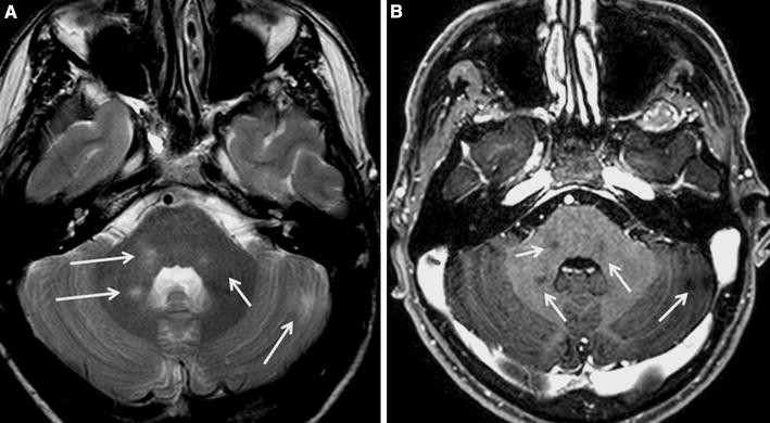 Neuroimage studies