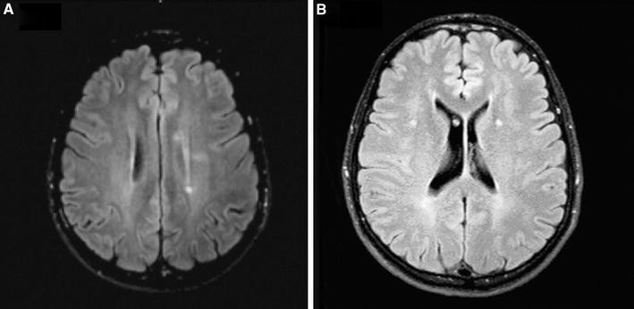 Neuroimage studies