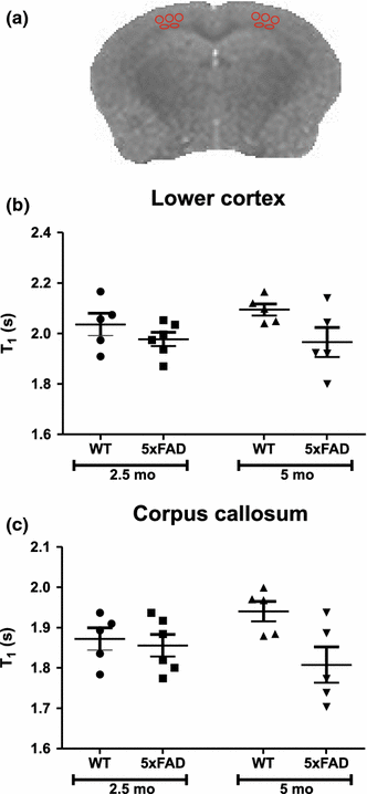 Can Mri T1 Be Used To Detect Early Changes In 5xfad