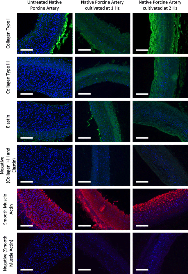 Pulsatile Perfusion Bioreactor System For Durability Testing And Compliance Estimation Of Tissue Engineered Vascular Grafts Springerlink