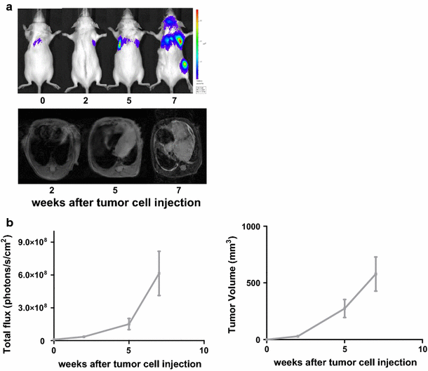 An orthotopic mouse model of small cell lung cancer reflects the