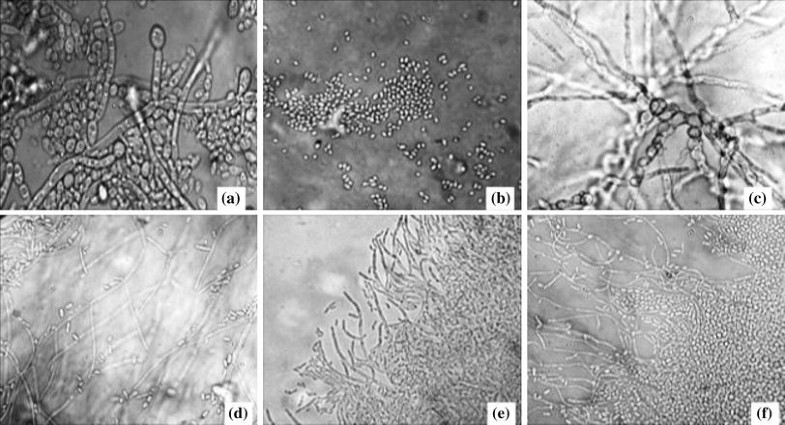 Candida identification: a journey from conventional to molecular ...