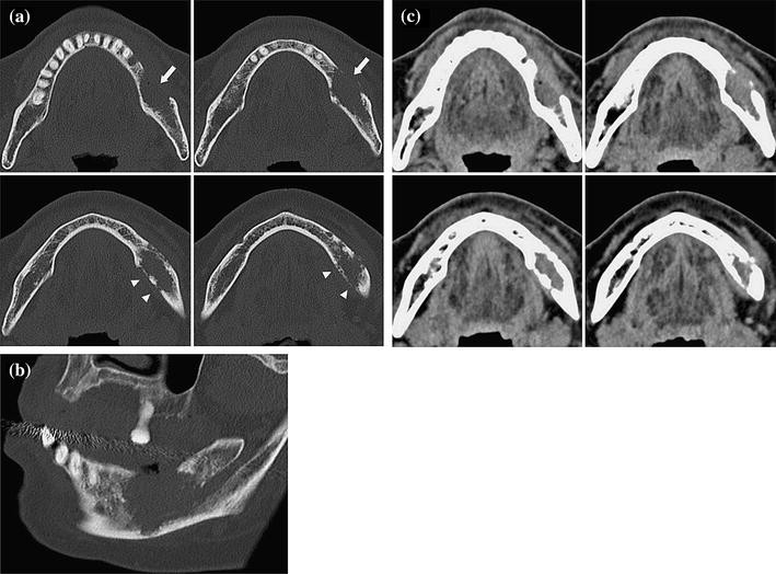 Utility of preoperative imaging diagnosis for a malignant tumor of the