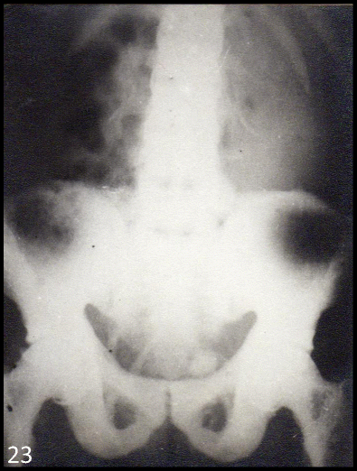 Status of industrial fluoride pollution and its diverse adverse health