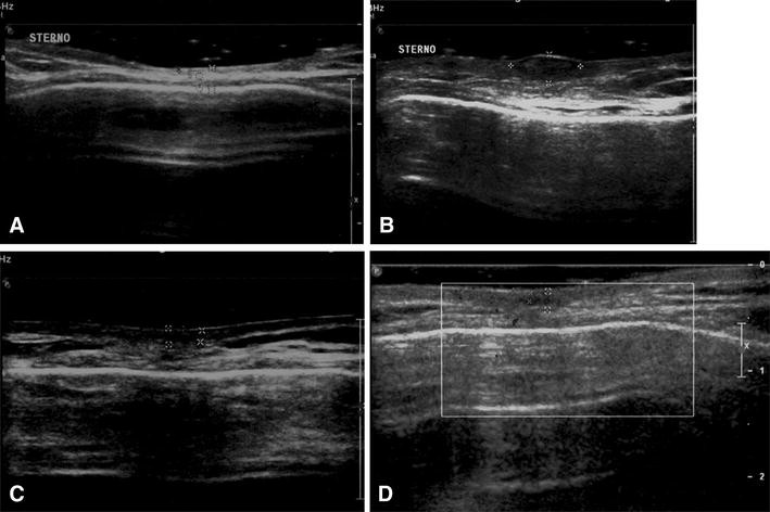 The utility of the high-resolution ultrasound technique in the ...