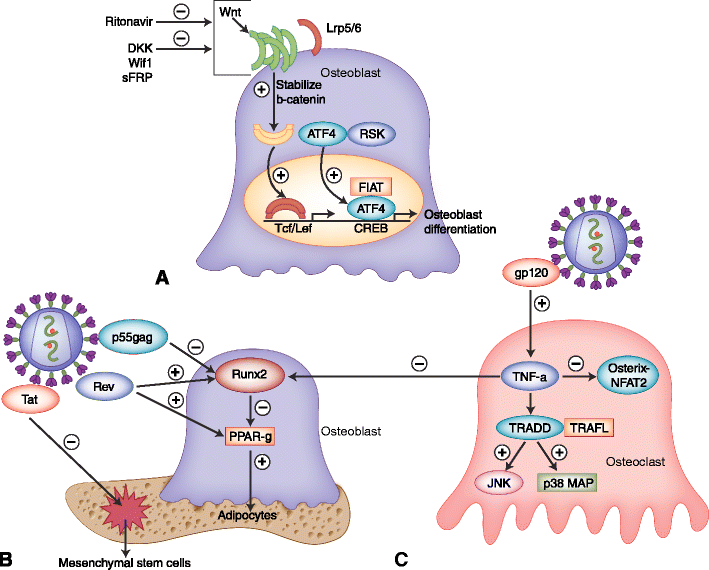 HIV and Bone Loss SpringerLink