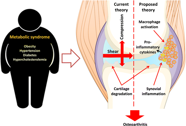 Is Synovial Macrophage Activation The Inflammatory Link Between Obesity ...