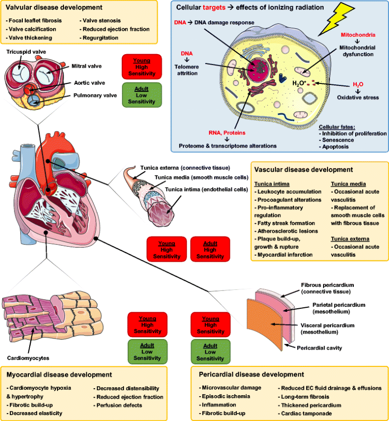RadiationInduced Cardiovascular Toxicity Mechanisms, Prevention, and