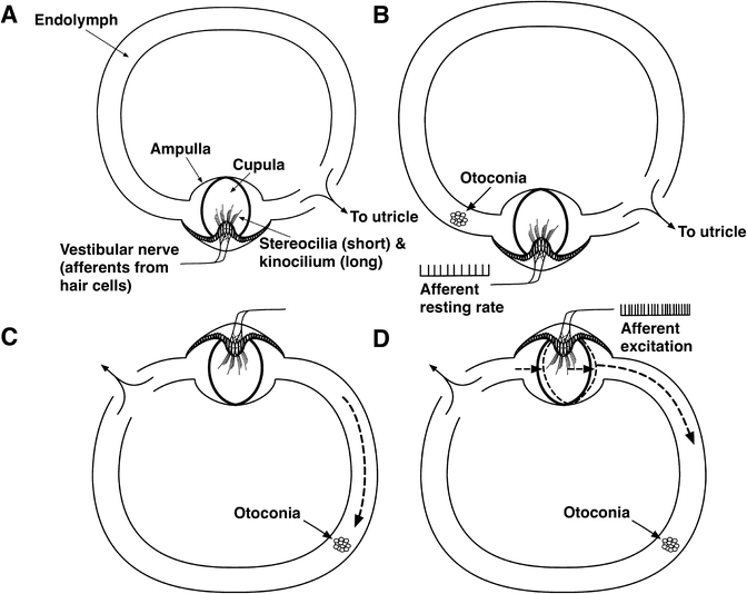 Repositioning Maneuvers for Benign Paroxysmal Positional Vertigo ...