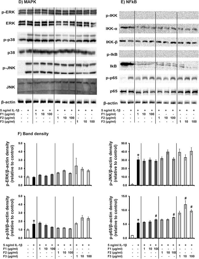 Fish Collagen Hydrolysates Modulate Cartilage Metabolism