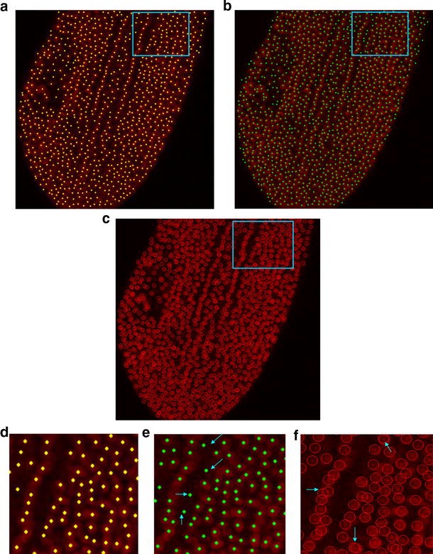 An Automated Method For Cell Detection In Zebrafish