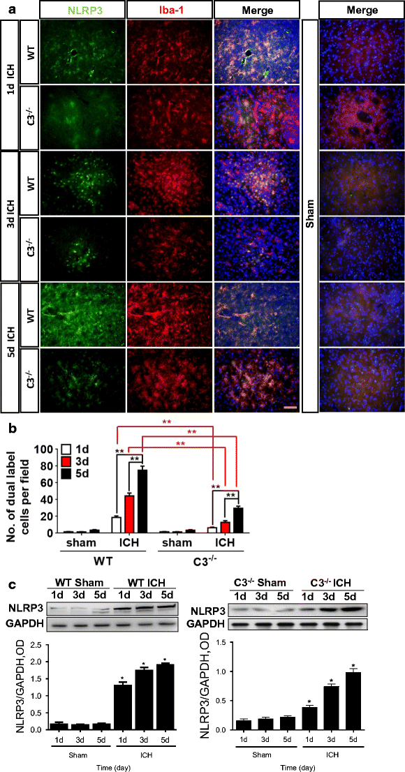 NLRP3 is Required for ComplementMediated Caspase1 and IL1beta