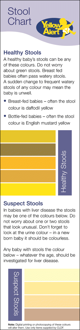 Jaundice Stool Colour Chart