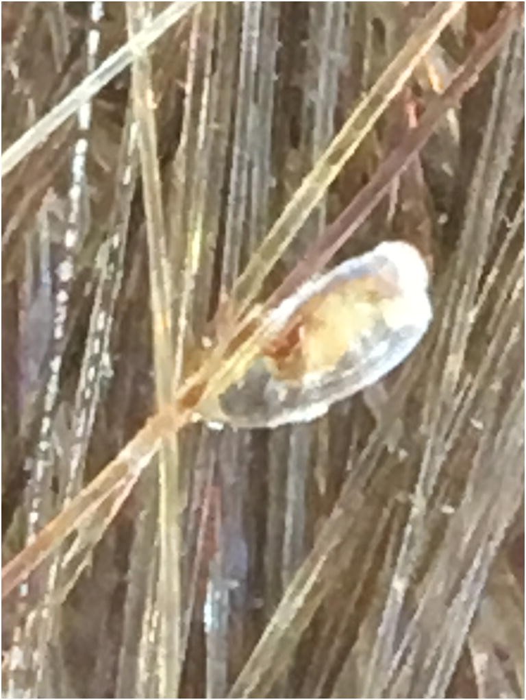 Head Louse Caught In The Act Springerlink