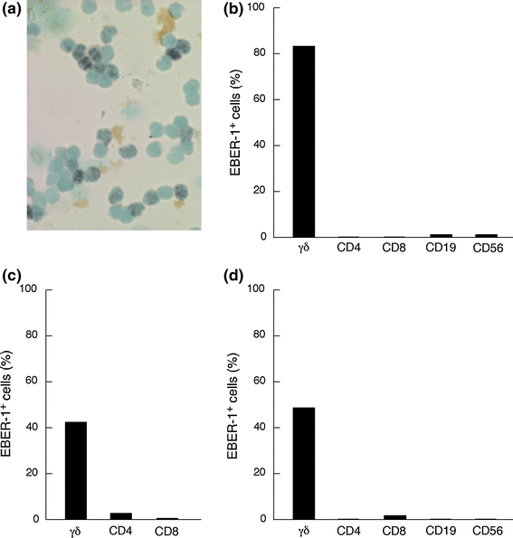 Clonal expansion of Epstein–Barr virus (EBV)-infected γδ T cells in ...