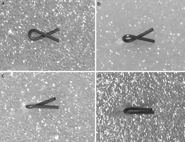 Evaluation of the sonographic visibility and sonographic appearance of