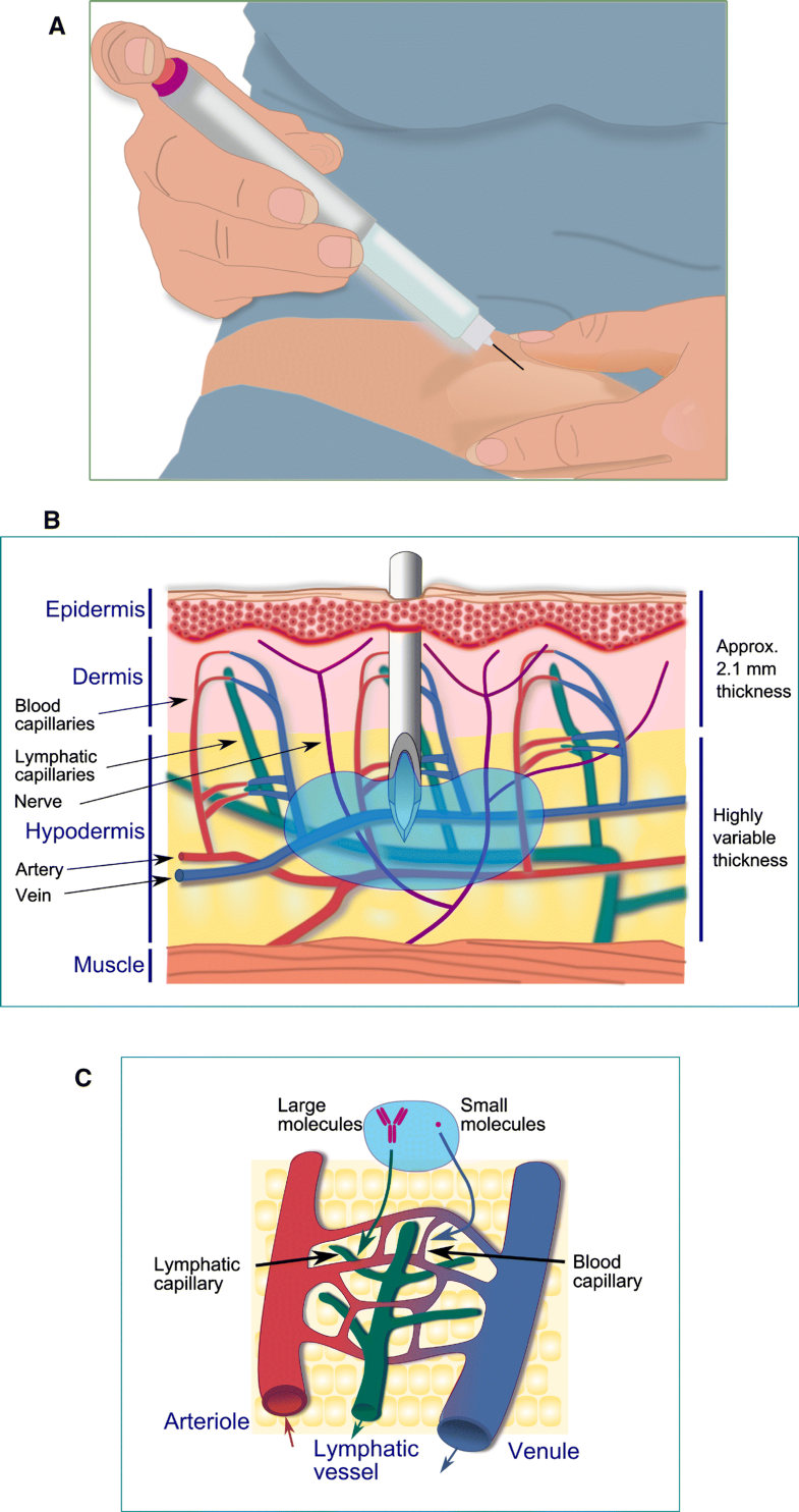 Subcutaneous Injection of Drugs Literature Review of Factors