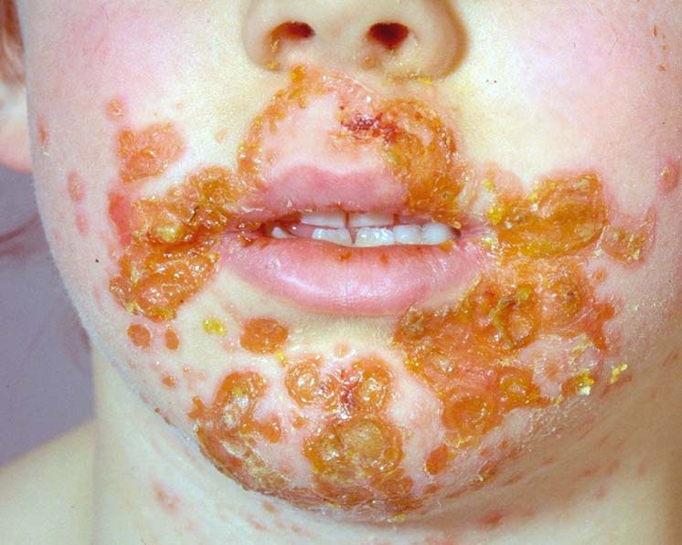 Oft auf die lippe beißen