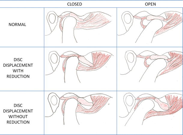 knee pain condition