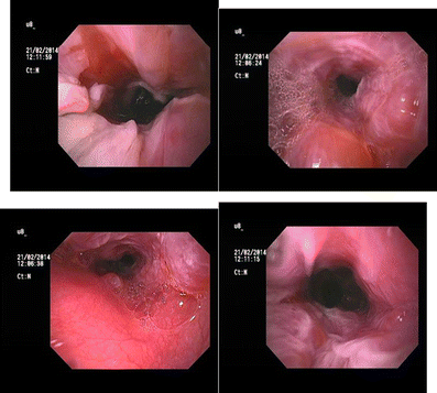 Indian Society Of Gastroenterology Springerlink
