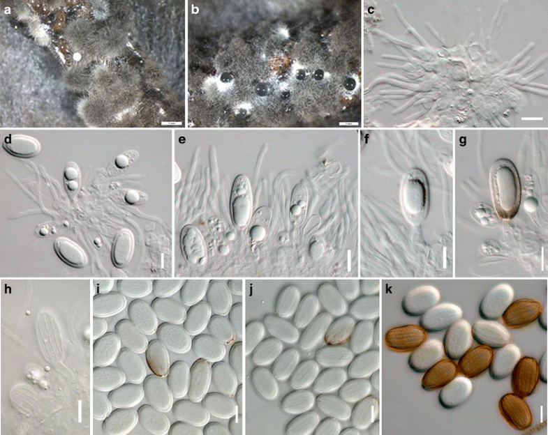 Taxonomy And Phylogeny Of Dematiaceous Coelomycetes