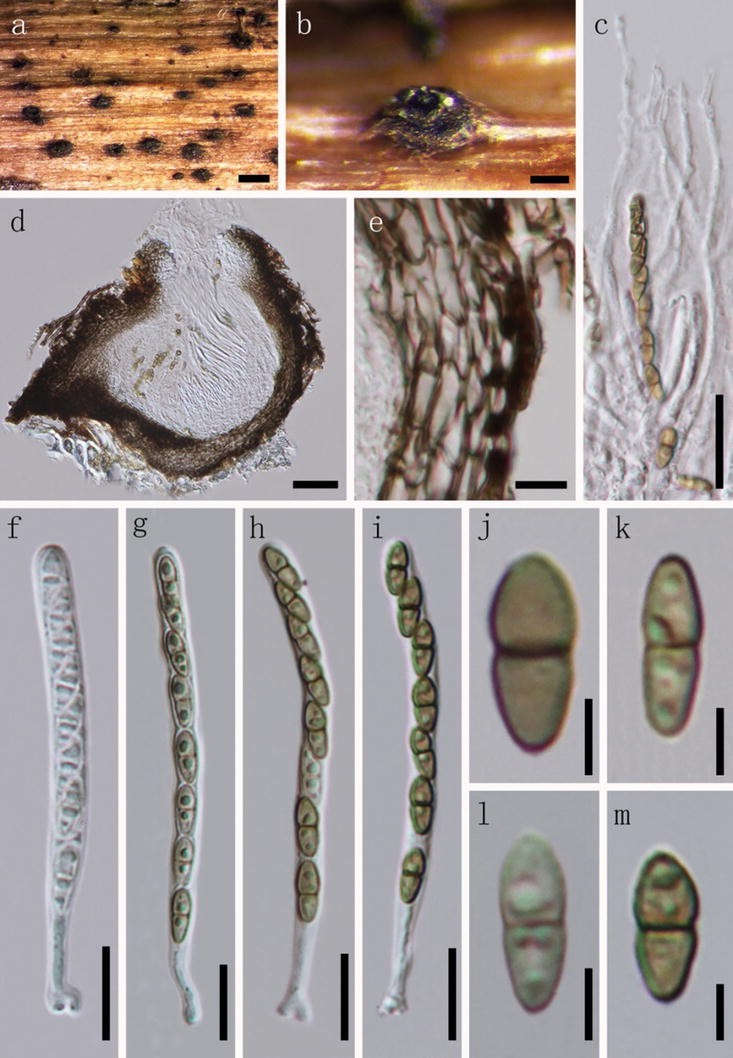 Fungal Diversity Notes 367490 Taxonomic And Phylogenetic - 