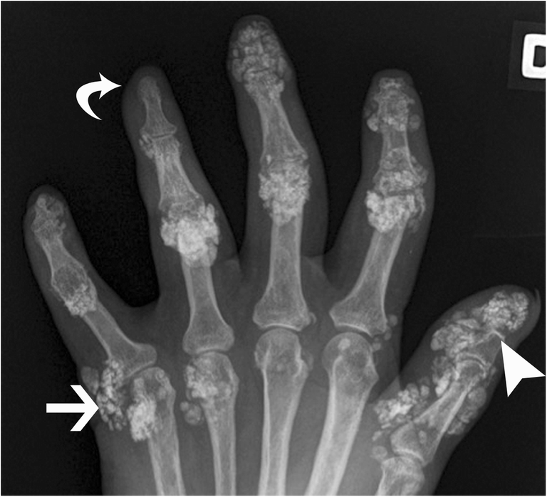 Radiological identification and analysis of soft tissue musculoskeletal