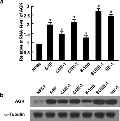 of acylglycerol kinase is associated with poorer prognosis and