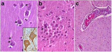 Perspectives in Diagnosis and Treatment of Rabies Viral Encephalitis