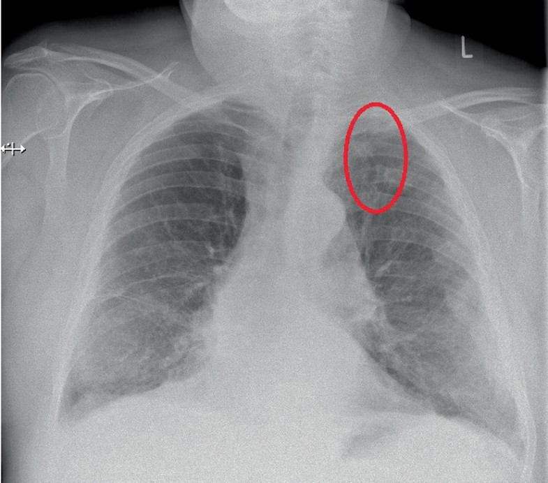 „Es knackt so beim Atmen“ SpringerLink