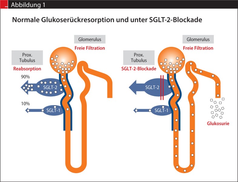 Welchen Stellenwert haben SGLT2Blocker? SpringerLink