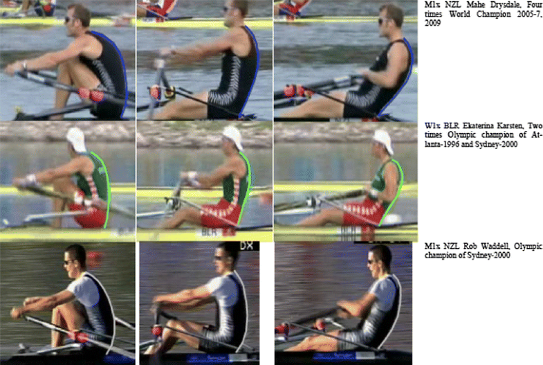 Rowing Injuries An Updated Review SpringerLink