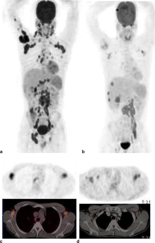 PET/CT imaging of Mycobacterium tuberculosis infection SpringerLink
