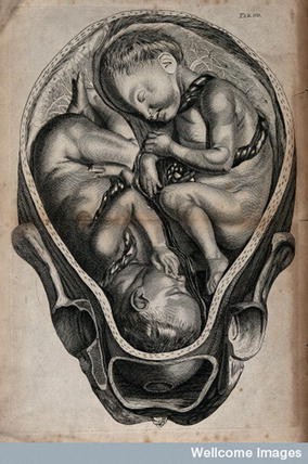 Visual Translations Medicine Art China And The West