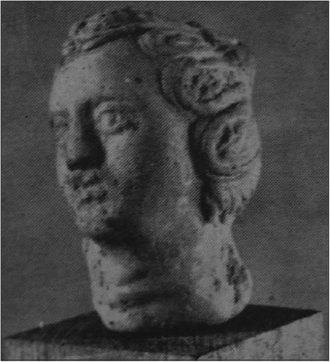 The Thyroid Gland In Ancient Greece A Historical - 