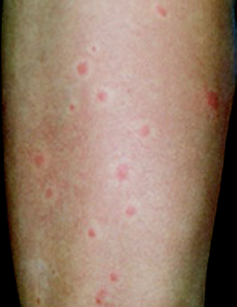 Dermatology For The Allergist World Allergy Organization Journal