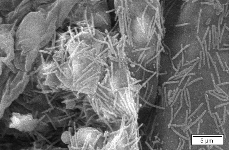 Columnaris disease in fish a review with emphasis on bacteriumhost