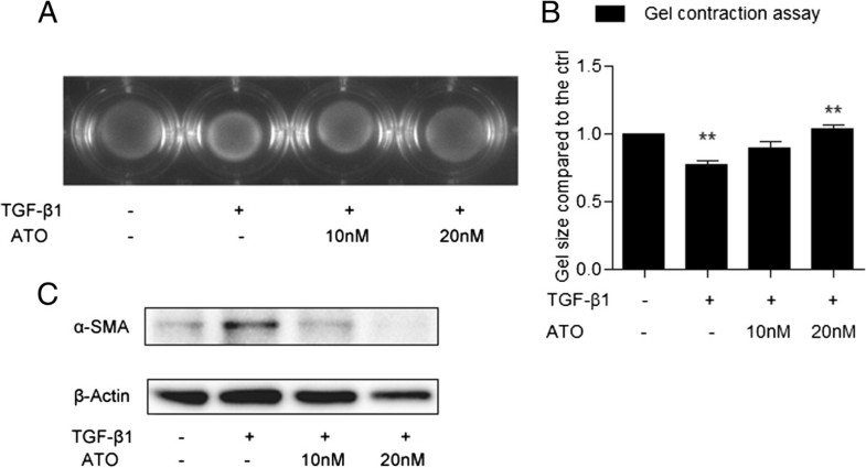 Nic Trioxide Inhibits Transforming Growth Factor β1 Induced Figure 2