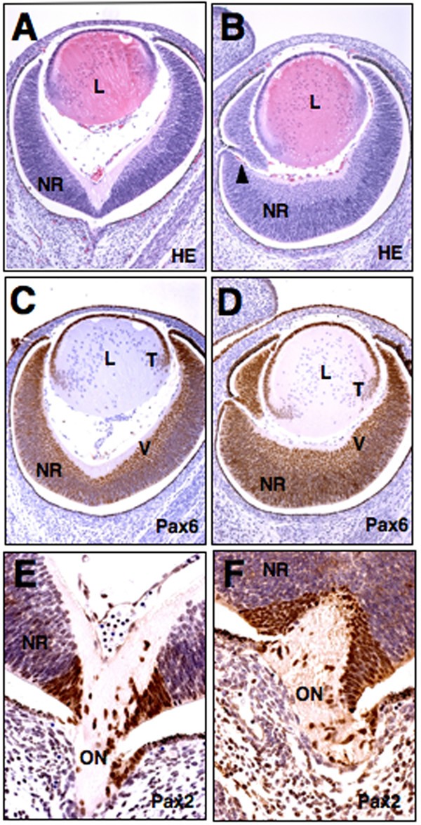 Rybp, a polycomb complex-associated protein, is required for mouse eye