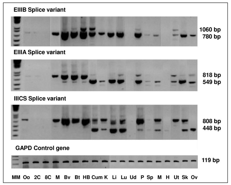 Splice Variants Reveal Connections >> Quantification Of Fibronectin 1 Fn1 Splice Variants Including Two Splice Variants Reveal Connections >> Quantification Of Fibronectin 1 Fn1 Splice Variants Including Two