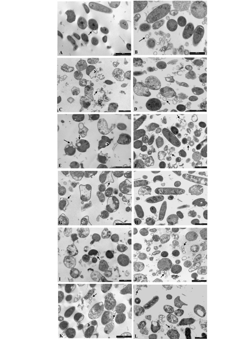 M c m De 30 Y 40 Polysorbate 80 and Helicobacter pylori: a microbiological and