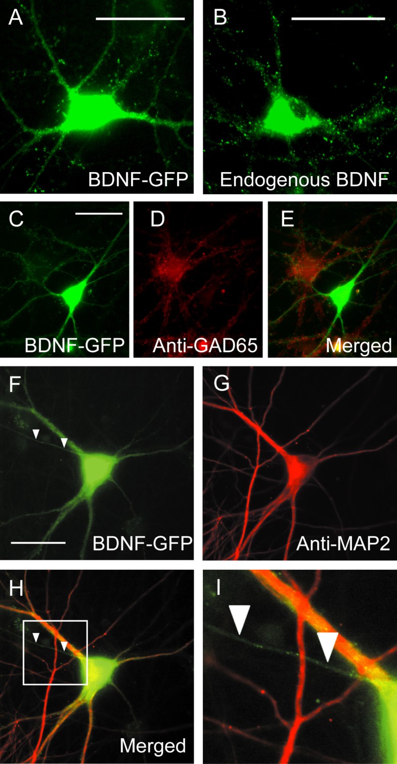 difference between axon and dendrite difference between axon and dendrite
