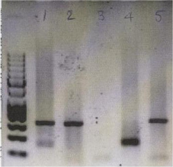 DNA extraction from longterm stored urine BMC Nephrology Full Text