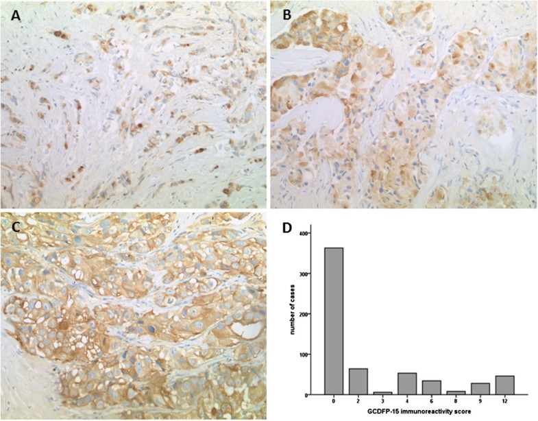 Gross cystic disease fluid protein 15 (GCDFP15) expression in breast